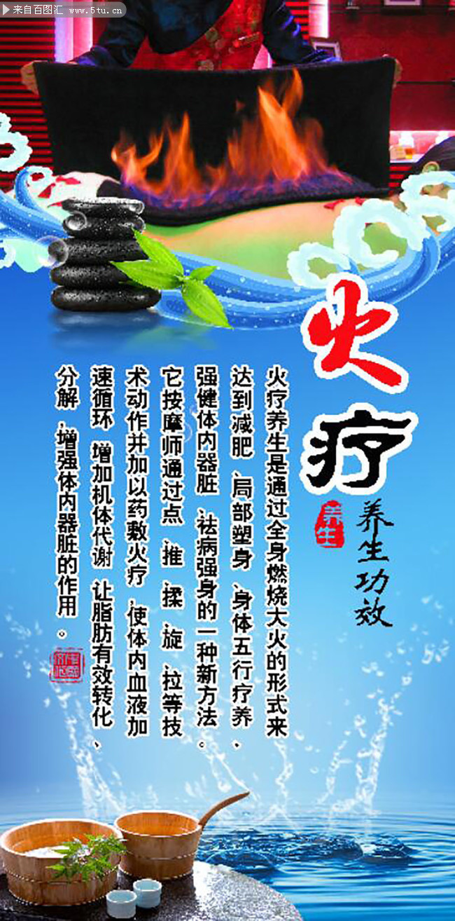 火疗介绍展板挂图