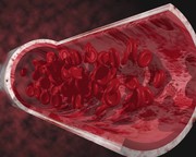 血管3D模拟图 
